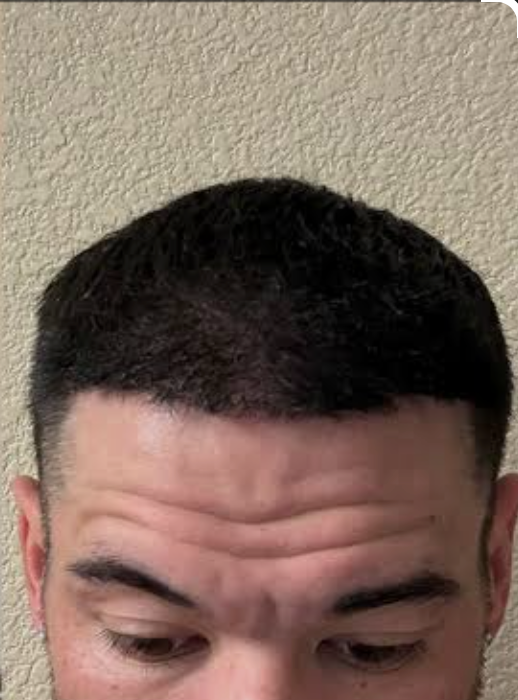 After