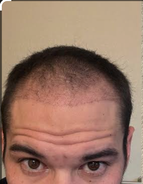 Before